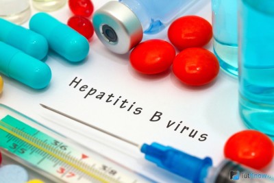 Гепатит В – симптомы и лечение фото